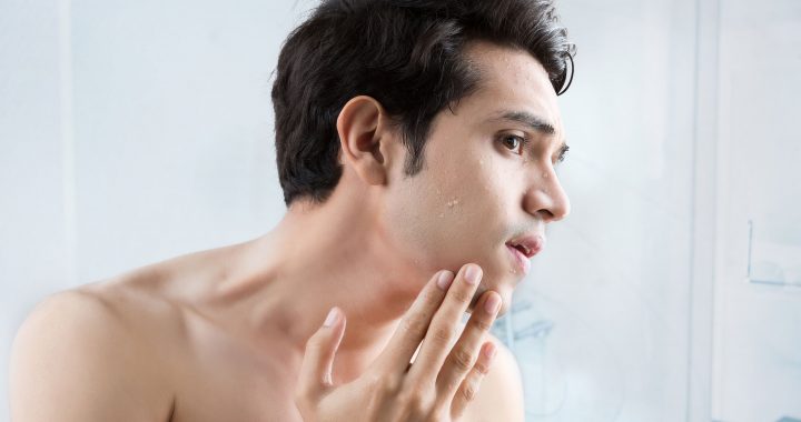 Man without spots after shaving